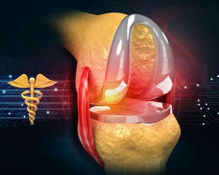 Photo for Human knee joint  replace anatomy on medical background. 3d illustration - Royalty Free Image