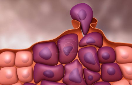 Téléchargez les photos : Croissance des cellules cancéreuses. Illustration 3d - en image libre de droit