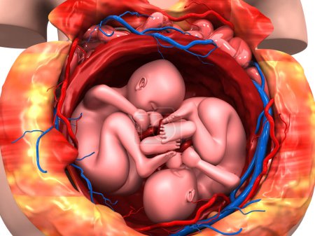 Téléchargez les photos : Fœtus jumeau dans l'utérus. Illustration 3d - en image libre de droit