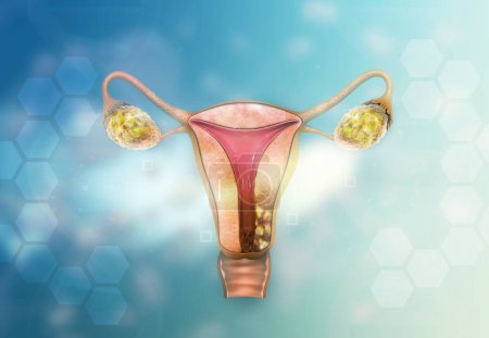 Téléchargez les photos : Anatomie des ovaires féminins. Illustration 3d - en image libre de droit