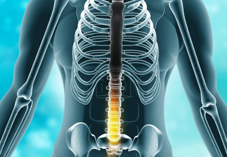 Foto de Dolor espinal humano. ilustración 3d - Imagen libre de derechos