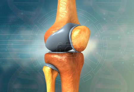 Foto de Anatomía de la rodilla humana. reemplazo de rodilla. ilustración 3d - Imagen libre de derechos