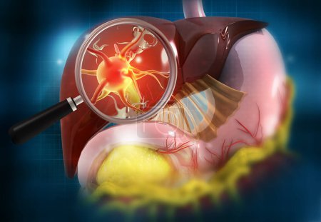 Foto de Hígado humano y lupa con virus. ilustración 3d - Imagen libre de derechos