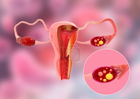 Photo for Female reproductive system. 3d illustration - Royalty Free Image