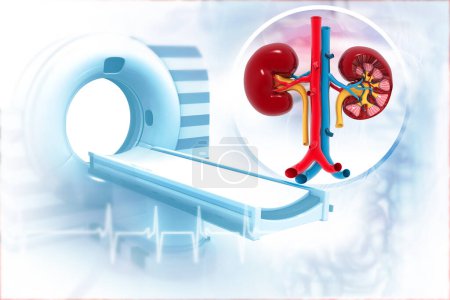 Photo for CT scanner machine with human kidney. 3d illustration - Royalty Free Image
