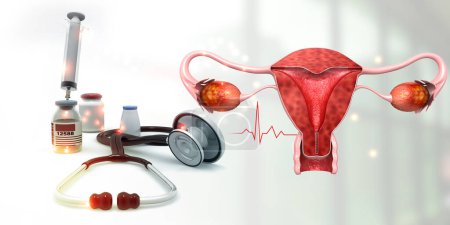 Foto de Modelo de anatomía del útero humano con estetoscopio y medicamentos. ilustración 3d - Imagen libre de derechos