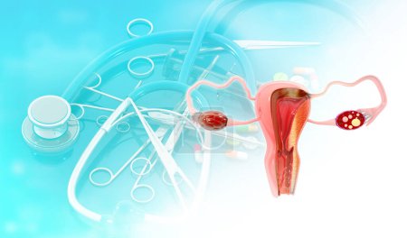 Photo for Female uterus anatomy on medical background. 3d illustration - Royalty Free Image