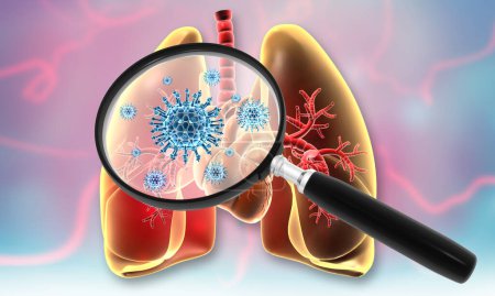 Photo for Virus infected lungs with magnifying glass. 3d illustration - Royalty Free Image