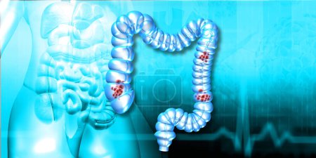 Photo for Human colon on medical background. 3d illustration - Royalty Free Image