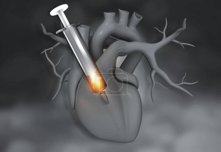 Foto de Corazón humano y aguja de inyección. ilustración 3d - Imagen libre de derechos