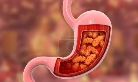 Téléchargez les photos : Micro bactéries dans l'estomac. Illustration 3d - en image libre de droit