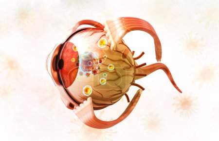 Foto de Concepto de cáncer ocular humano. Anatomía ocular. ilustración 3d - Imagen libre de derechos