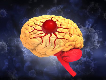 Téléchargez les photos : Anatomie du cancer du cerveau. Illustration 3d - en image libre de droit
