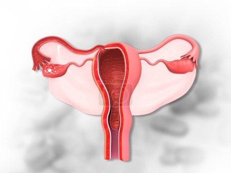 Téléchargez les photos : Utérus et ovaires avec trompes de Fallope. Illustration 3d - en image libre de droit
