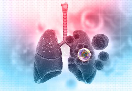 Téléchargez les photos : Concept de cancer du poumon humain. Illustration 3d - en image libre de droit