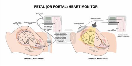 Illustration for Fetal (or foetal) heart monitor medical equipment illustration - Royalty Free Image