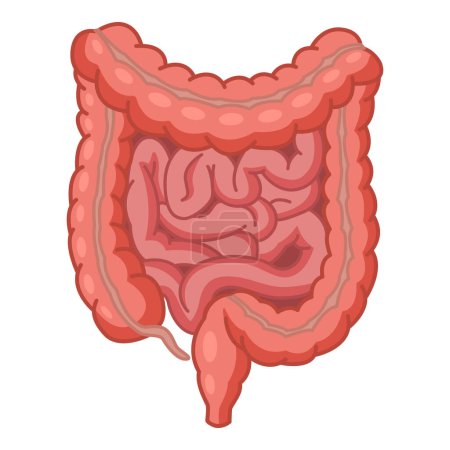 Der menschliche Dick- und Dünndarm. Anatomie des Darms. Vektorillustration der inneren Organe. Medizinkonzept