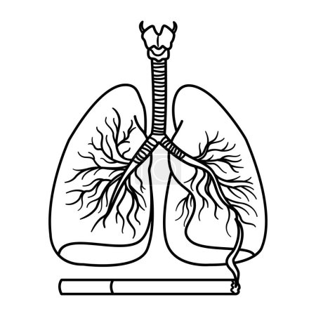 Ilustración de Pulmón saludable y pulmón de fumador para colorear. El efecto del tabaquismo en el sistema respiratorio humano. Cáncer de pulmón. Ilustración vectorial de órganos internos humanos - Imagen libre de derechos
