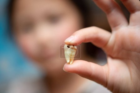 Téléchargez les photos : L'enfant a une carie dentaire - en image libre de droit