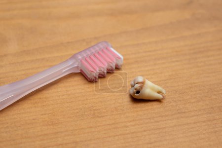 Foto de Cepillo de dientes y caries están sobre la mesa - Imagen libre de derechos