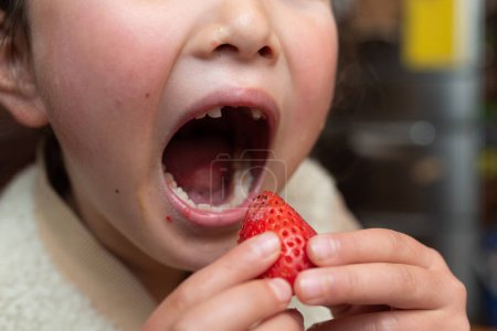 Foto de Un niño con dientes delanteros perdidos come fresa - Imagen libre de derechos