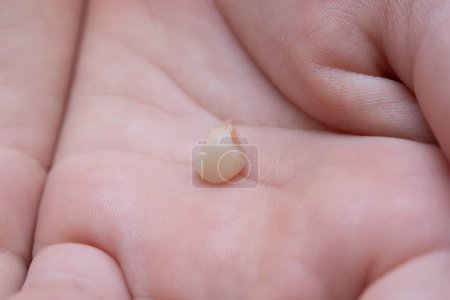 Photo for Child's hand with a baby tooth that has just fallen out - Royalty Free Image