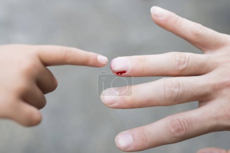 Bleeding fingertip close up