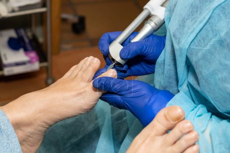 Téléchargez les photos : Podiatre travaille soigneusement sur ses patients ongles d'orteils avec un tableau médical emery. Pédicure médicale. Photo de haute qualité - en image libre de droit