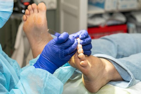 Podólogo trabaja cuidadosamente en las uñas de sus pacientes. La paciente se relaja mientras el podólogo trabaja en sus uñas. Foto de alta calidad