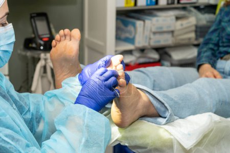 Photo for Podiatrist carefully cleans her patients toenails. Nail treatment. Podiatrist attending to her patient. High quality photo - Royalty Free Image