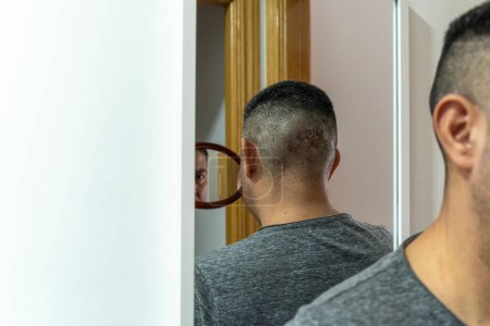 A man, after fainting, examines his head wound with staples using bathroom mirror and handheld mirror