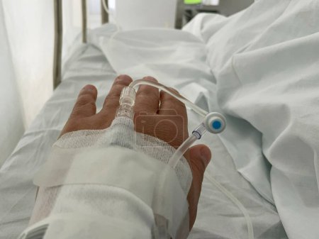 Eine Hand mit einer IV-Linie in einem Krankenhaus, das intravenöse Flüssigkeit erhält. Die Nahaufnahme erfasst die medizinische Versorgung in einem klinischen Umfeld. Hochwertiges Foto