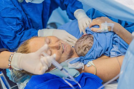 Photo for Baby on mothers chest immediately after birth in a hospital. The mother and newborn share a tender moment, emphasizing the bond and emotional connection. The medical staff ensures a safe and caring - Royalty Free Image