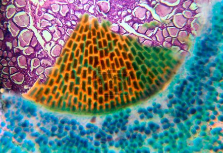 Slice , Pictorial art of transverse section of a fungus fruiting body , In the photo it resembles a slice of water melon , the background is the thyroid gland transverse section micro photo