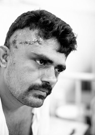 Foto de Abdul Rashid un ciudadano herido recuperándose en el hospital JJ durante las recientes explosiones de bombas el 26 de noviembre de 2008 en Bombay Mumbai, Maharashtra, India - Imagen libre de derechos