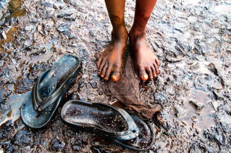 Photo for Boy showing oil soaked feet due to container ship chitra colliding in sea Bombay Mumbai , Maharashtra , India - Royalty Free Image