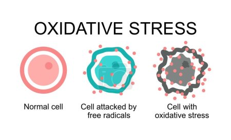 Illustration for Vector oxidative stress symbols isolated on white background. normal cell, cell attacked by free radicals and cell with oxidative stress - Royalty Free Image