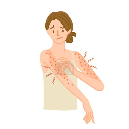 Illustration for A woman whose arm skin is rough, inflamed, and itchy due to an allergic reaction. - Royalty Free Image