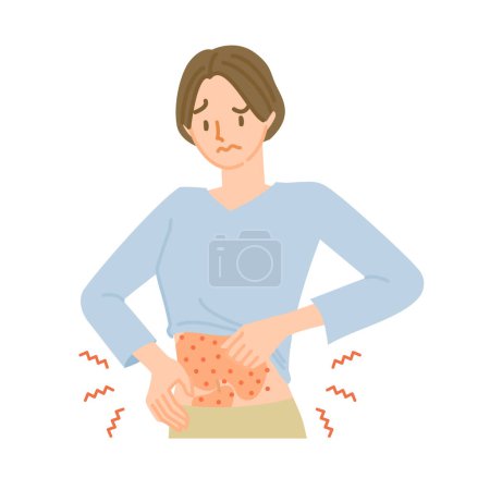Una mujer cuya piel estomacal es áspera, inflamada y con picazón debido a una reacción alérgica