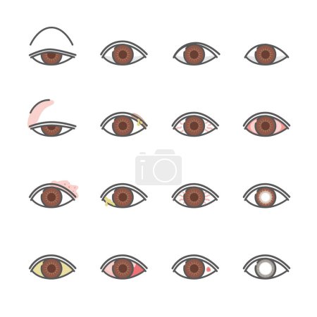 Téléchargez les illustrations : 12 types d'icônes de troubles oculaires - en licence libre de droit