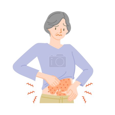 Illustration for Skin disease: Senior woman irritated by itchy skin on her stomach - Royalty Free Image