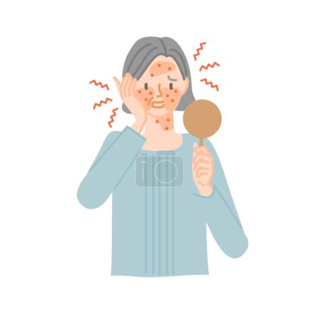 Illustration for A senior woman whose facial skin is inflamed and itchy (hay fever dermatitis) - Royalty Free Image