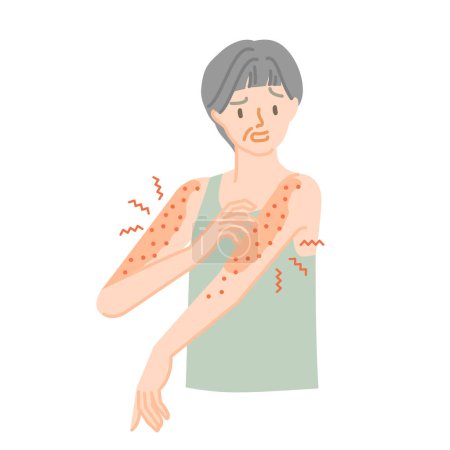 Illustration for Skin disease: Senior woman irritated by itchy arms - Royalty Free Image