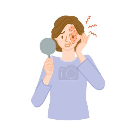Herpes zóster: mujer de mediana edad con dolor, picazón e hinchazón en la cara.