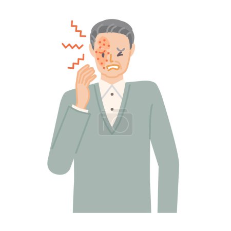 Gürtelrose: Ein älterer Mann mit Schmerzen, Juckreiz und Schwellungen im Gesicht