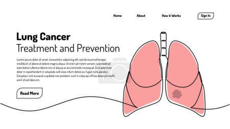 Téléchargez les illustrations : Cancer du poumon dessin d'art continu d'une ligne. Modèle de page de destination web. Illustration vectorielle d'organe humain santé concept médical. - en licence libre de droit