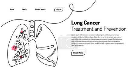 Illustration for Lungs cancer continuous one line art drawing. Landing page web template. Vector human organ illustration healthcare medical concept. - Royalty Free Image