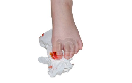 Bleeding wound on toe, isolated on white. concept of pain