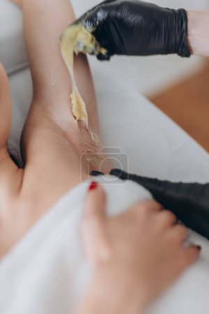 Photo for Sugaring: epilation with liquate sugar at armpit. High quality photo - Royalty Free Image