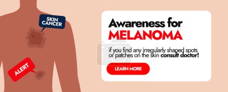 Melanoma Skin cancer. Skin cancer awareness cover with Melanoma cancer spots on men back or front. Awareness social media cover for Cancer Patients. Melanoma warning signs. Skin Infection, Diseases